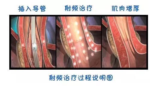PD8DBHYW~I9G@KN[NH`5BAB.png PD8DBHYW~I9G@KN[NH`5BAB.png