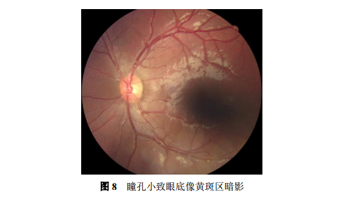 微信图片_20180323172459.png